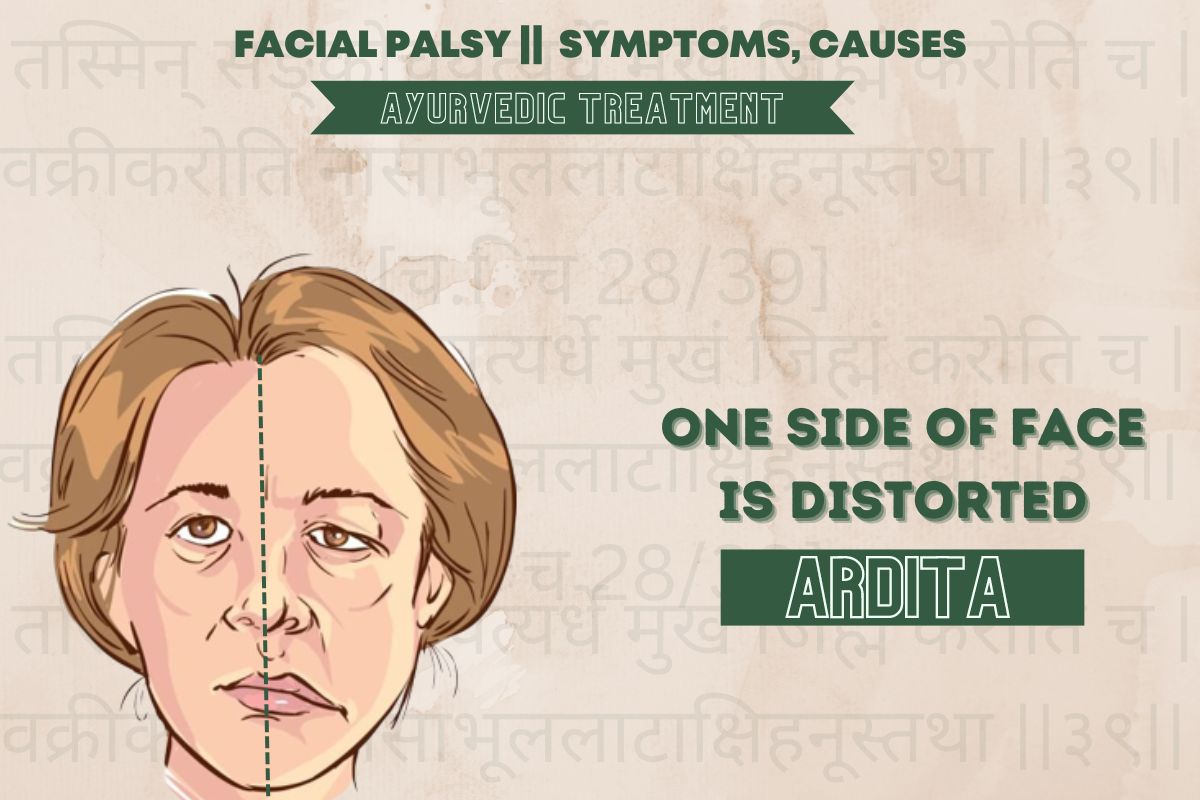 Facial Palsy Treatment in Ayurveda